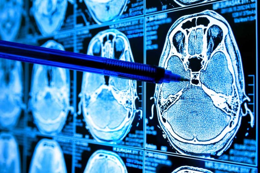 Sztuczna inteligencja w radiologii